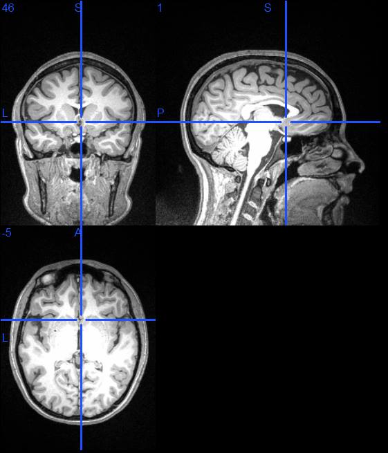 An MRI of Dr. Danielle Giangrasso's brain.