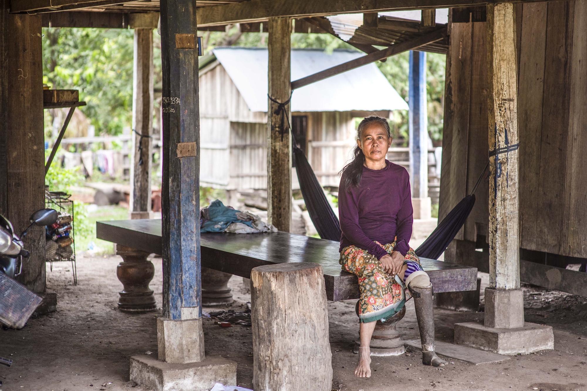  Mine Victim Sida sits in hammock at home, Cambodia